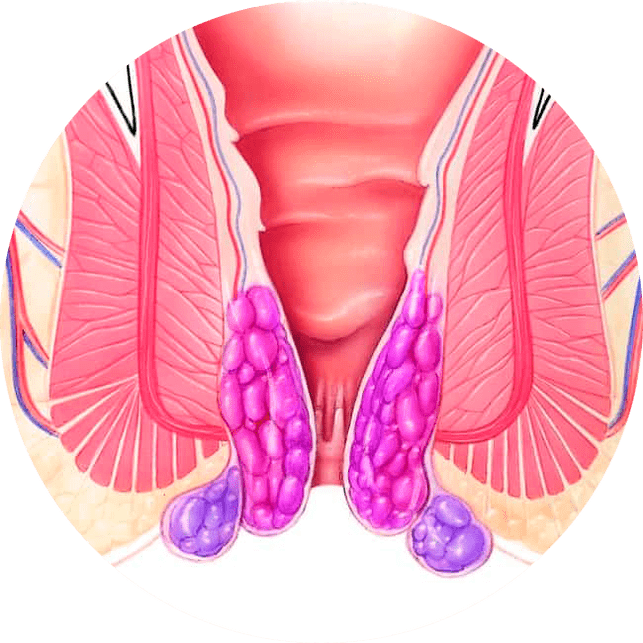 Gelarex palengvina simptomus nuo pirmojo naudojimo